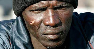 home negre ferit noi